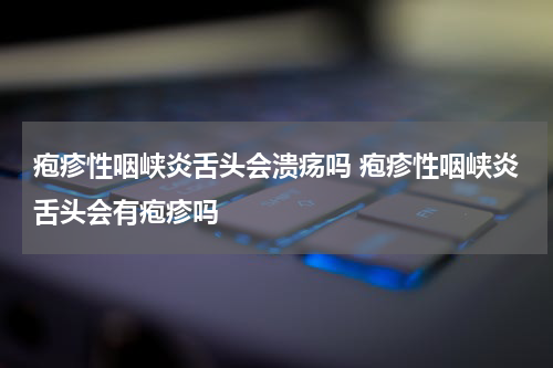 疱疹性咽峡炎舌头会溃疡吗 疱疹性咽峡炎舌头会有疱疹吗