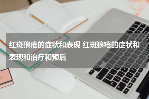 红斑狼疮的症状和表现 红斑狼疮的症状和表现和治疗和预后