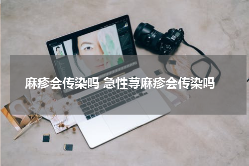 麻疹会传染吗 急性荨麻疹会传染吗