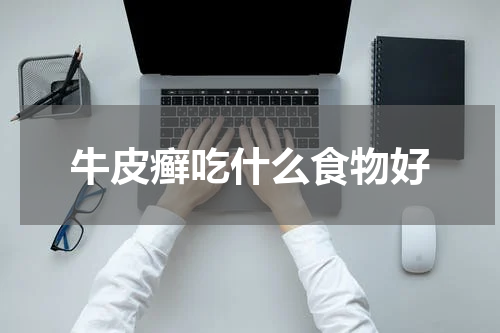 牛皮癣吃什么食物好
