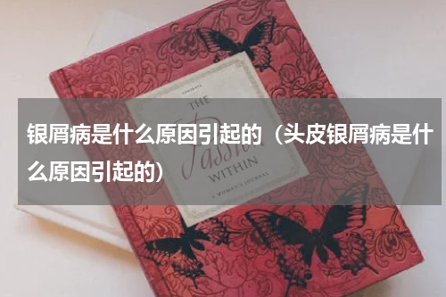 银屑病是什么原因引起的（头皮银屑病是什么原因引起的）