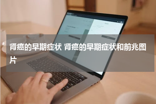 肾癌的早期症状 肾癌的早期症状和前兆图片