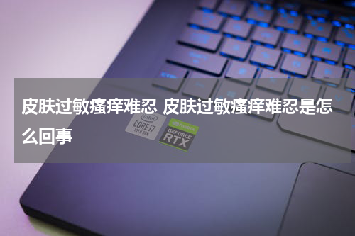 皮肤过敏瘙痒难忍 皮肤过敏瘙痒难忍是怎么回事