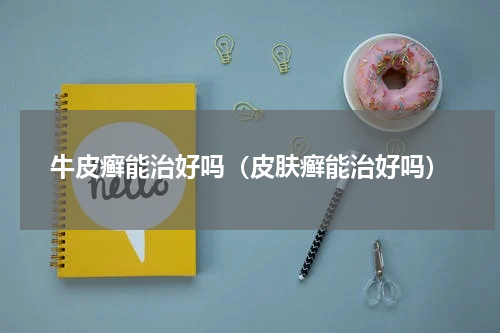 牛皮癣能治好吗（皮肤癣能治好吗）