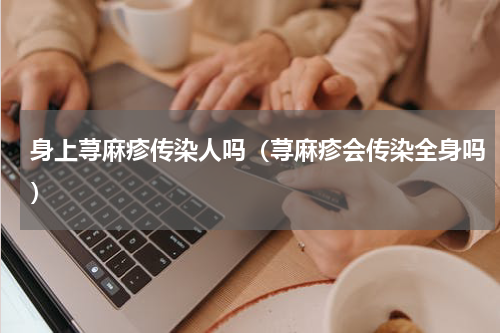 身上荨麻疹传染人吗（荨麻疹会传染全身吗）